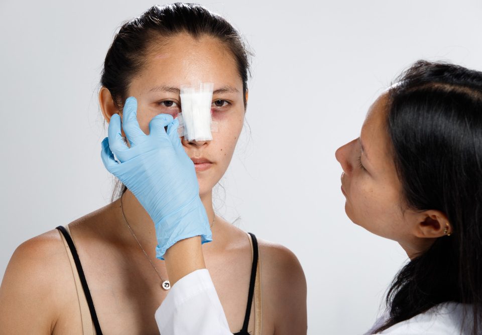 Combien coûte une rhinoplastie