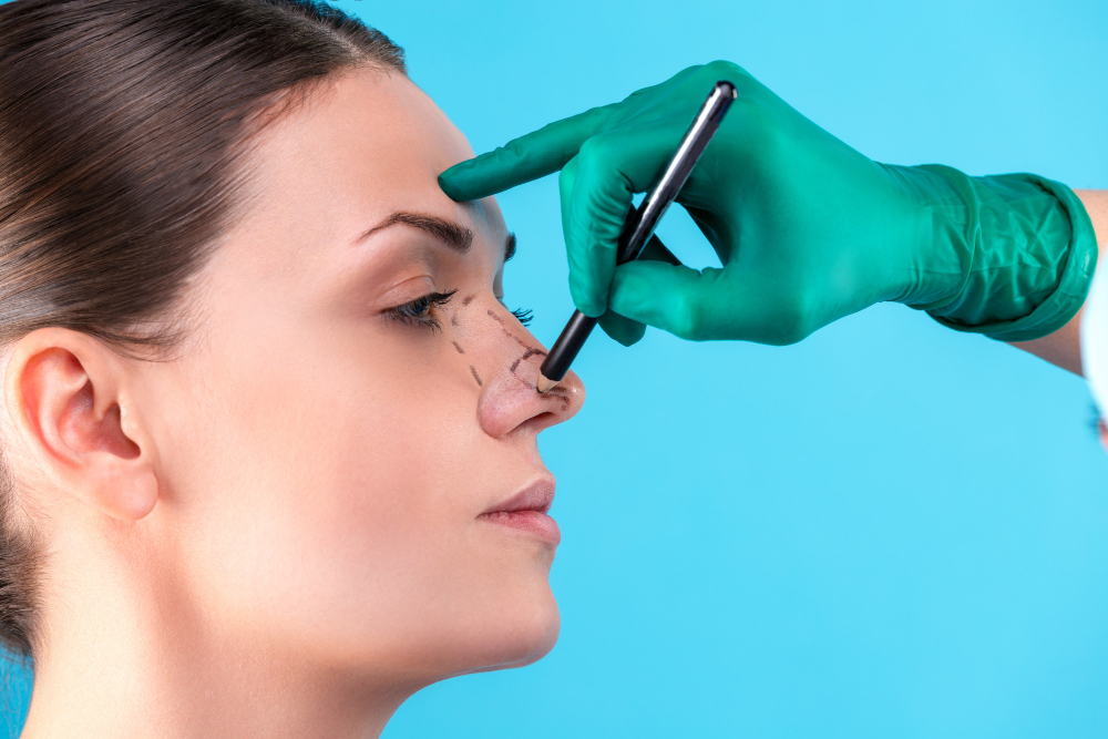 Les facteurs qui influencent le prix d'une rhinoplastie